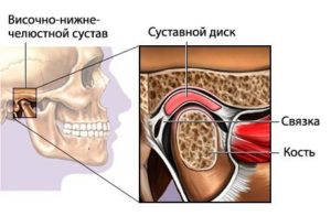 ВНЧС 2